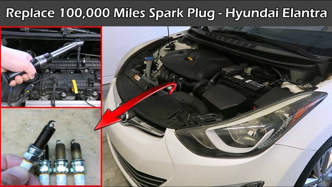 hyundai elantra spark plugs